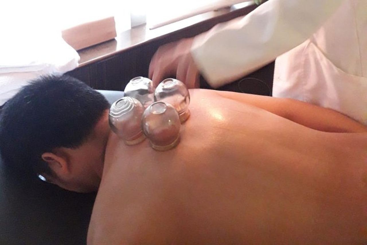 Esperienza di medicina tradizionale cinese — 2